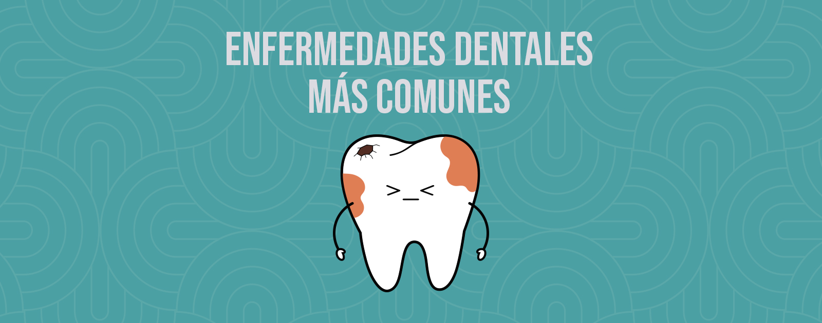 Enfermedades Dentales Más Comunes Y Su Tratamiento 2629