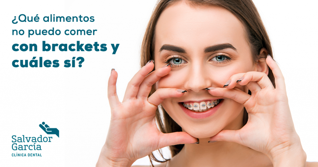 ¿Qué alimentos no puedo comer con brackets y cuáles sí?