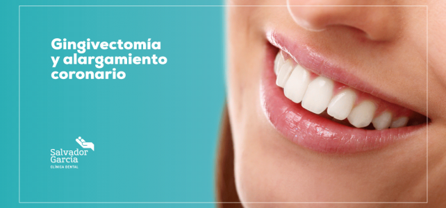 ¿Gingivectomía o alargamiento coronario?