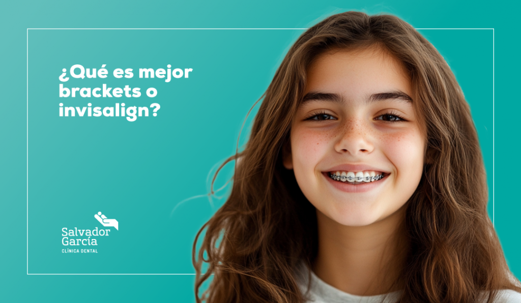 Brackets o invisalign ¿Qué es mejor?