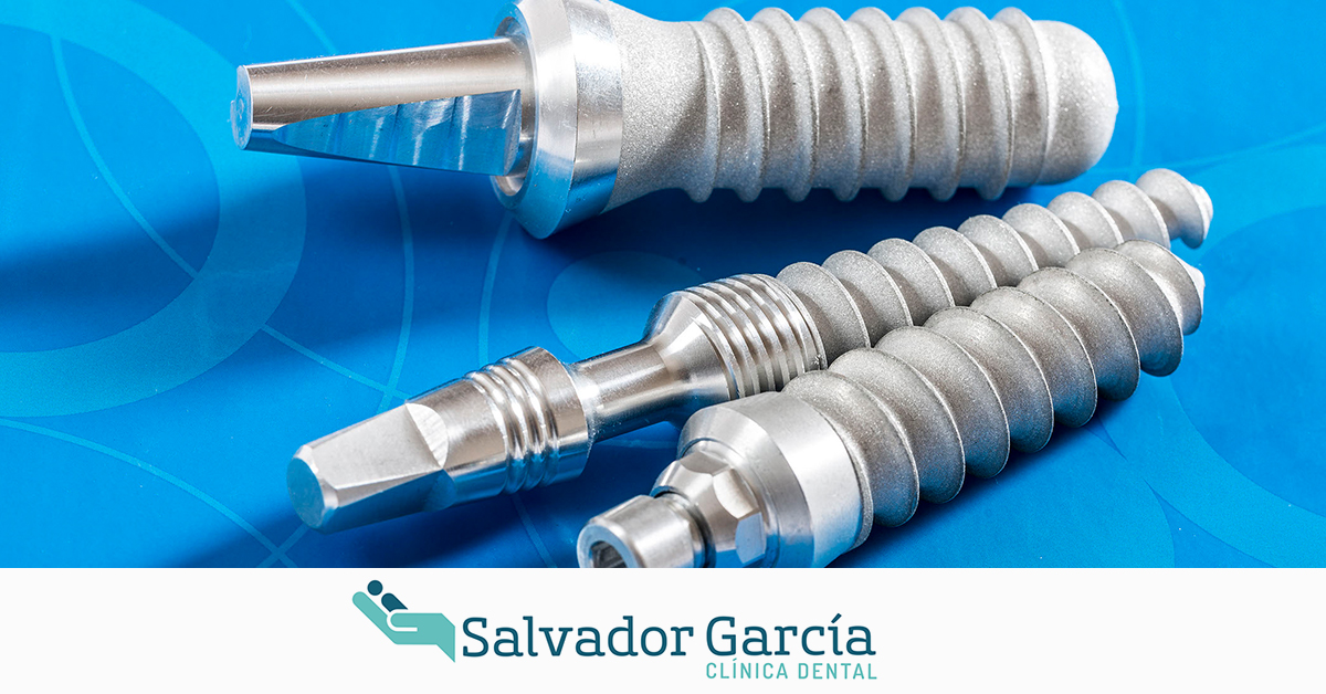 Implantes Dentales En Malaga Implantologia Dental Salvador Garcia